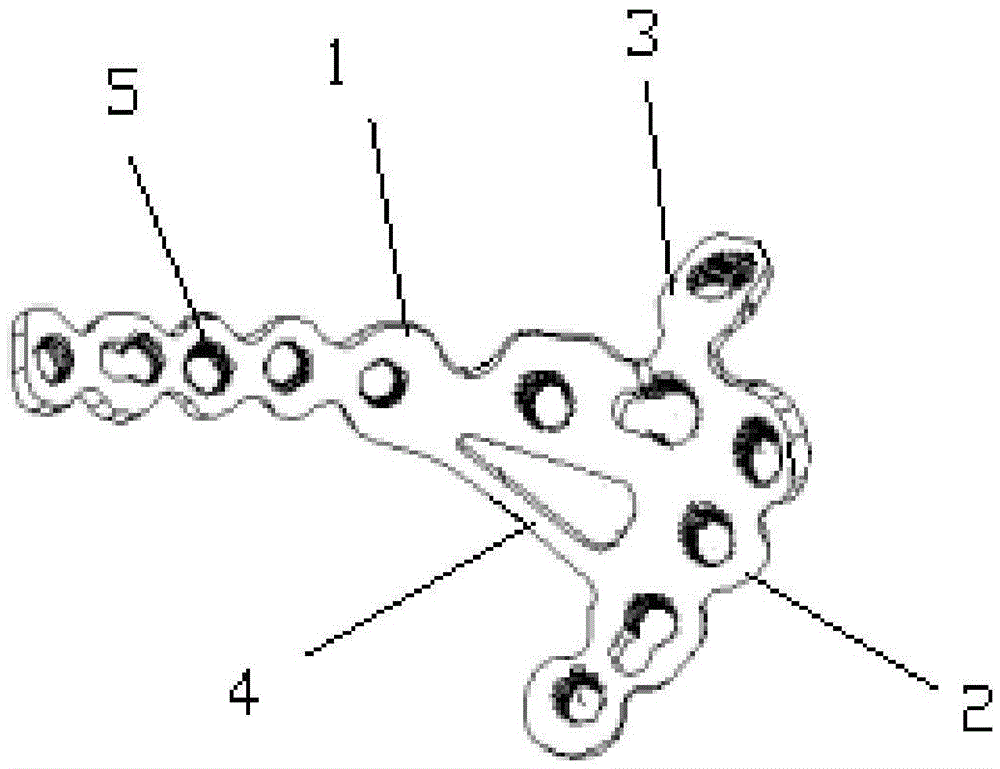 Acetabulum square area bone fracture plate