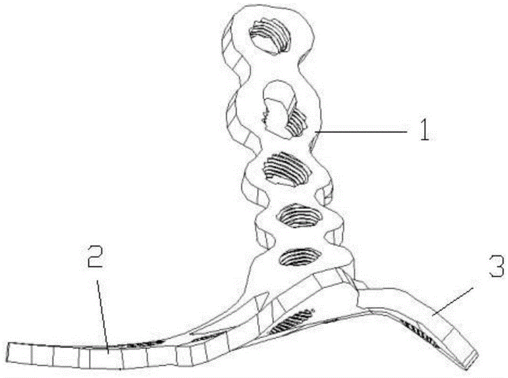 Acetabulum square area bone fracture plate