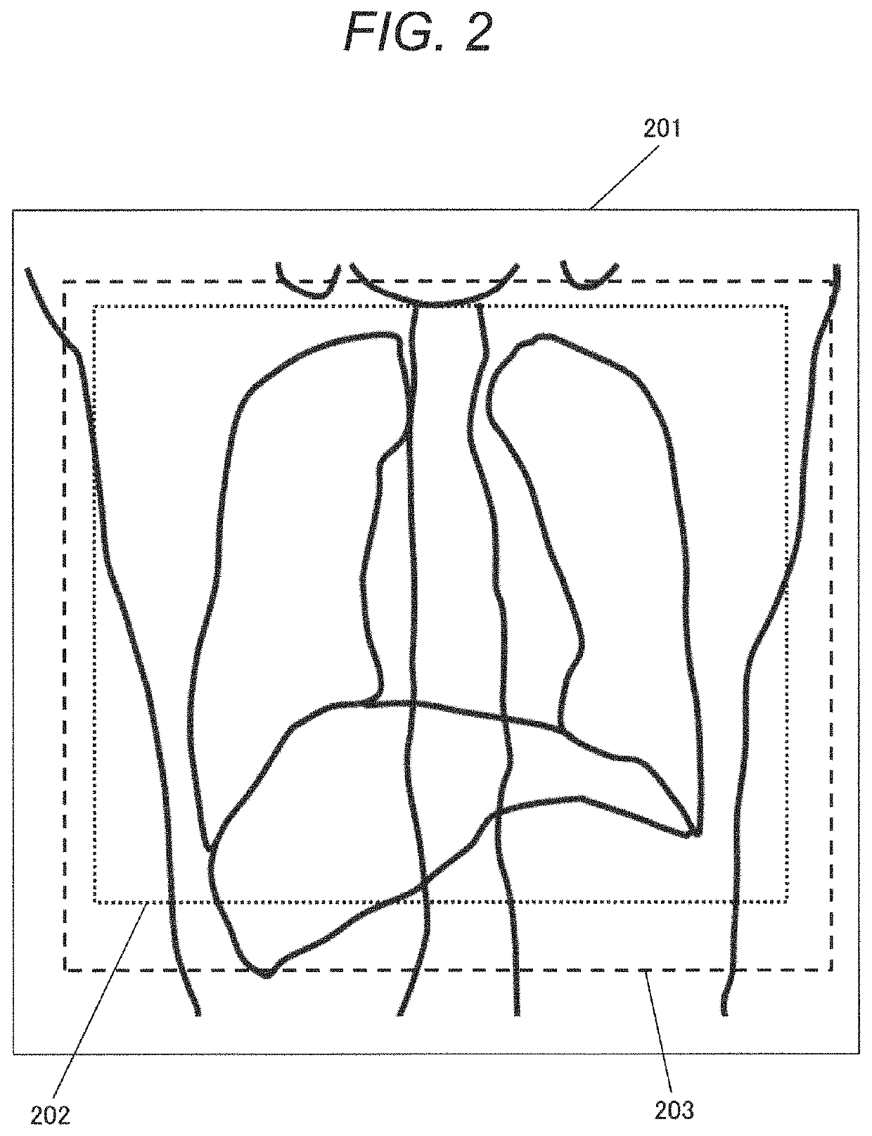 Medical image diagnostic device and image processing method