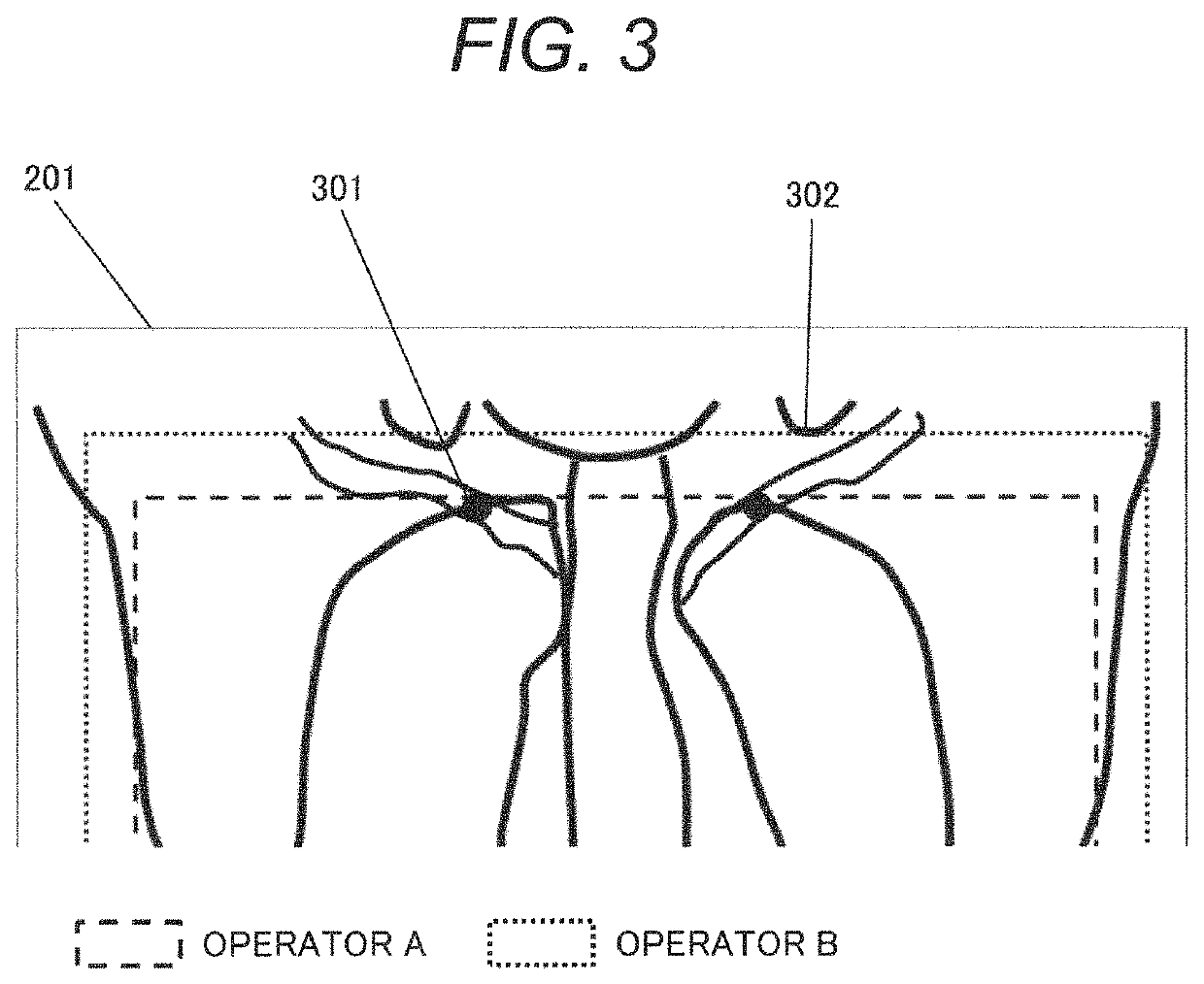 Medical image diagnostic device and image processing method