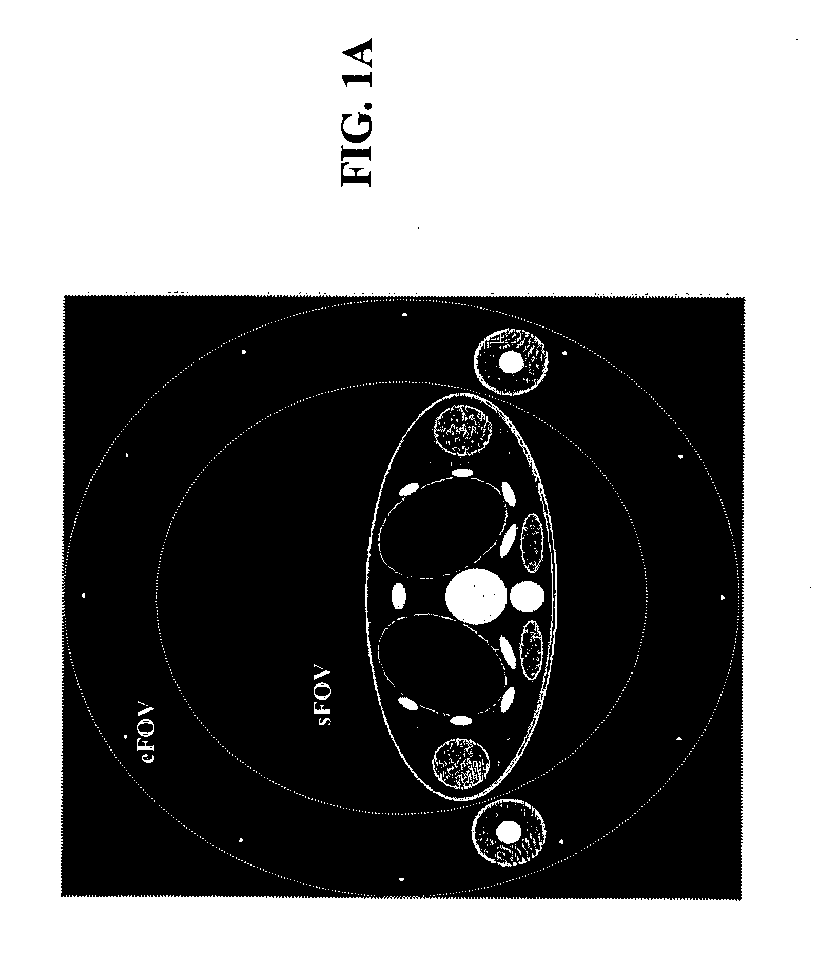 Method, apparatus, and computer program product for sinogram completion