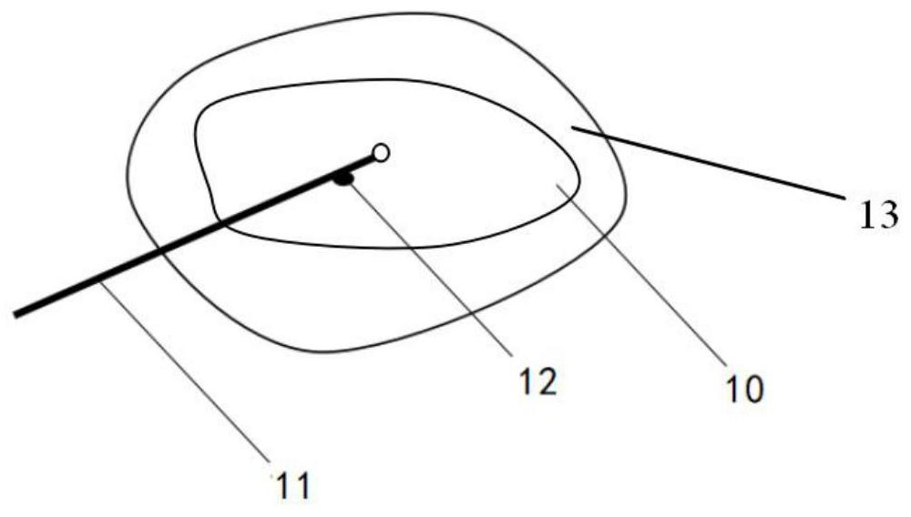 Ablation catheter and ablation device for image-guided ablation