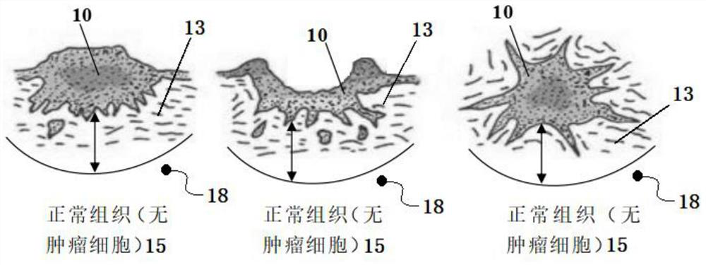 Ablation catheter and ablation device for image-guided ablation