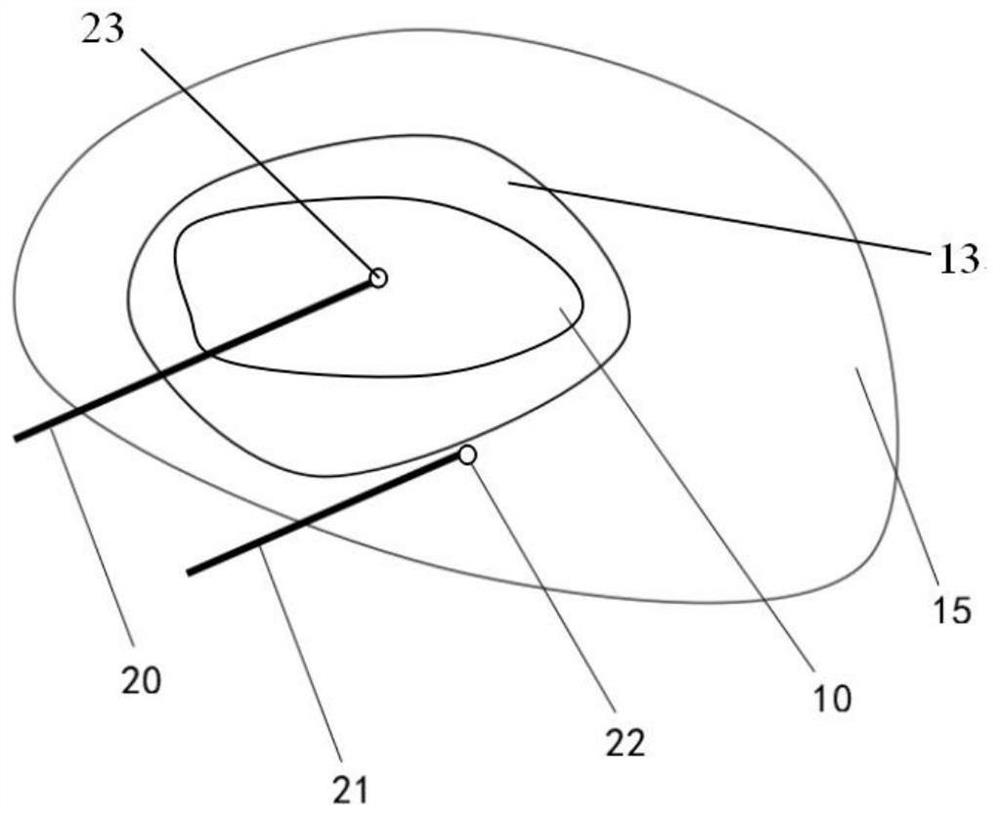 Ablation catheter and ablation device for image-guided ablation