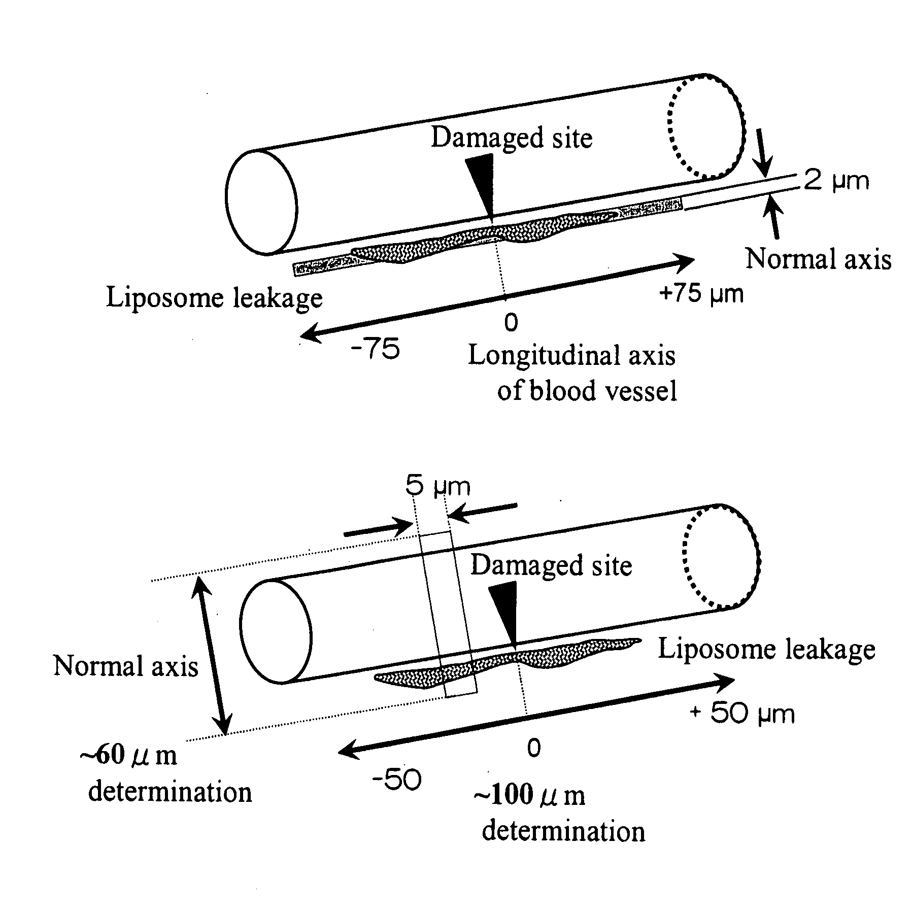 Support Accumulating In Injured Part In Vascular Channel