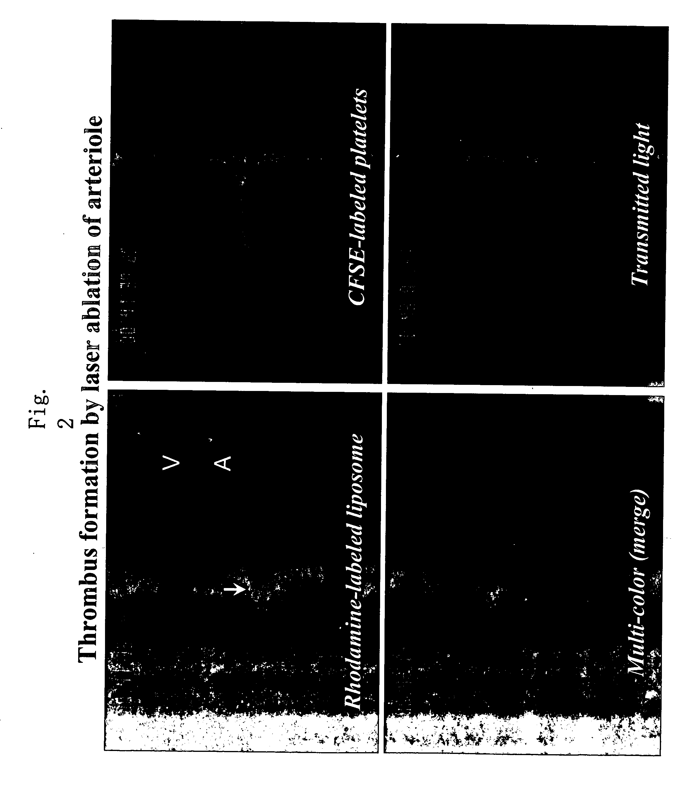 Support Accumulating In Injured Part In Vascular Channel