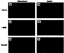 Culture solution and method for inducing mesenchymal stem cells to differentiate into glomerular mesangial cells