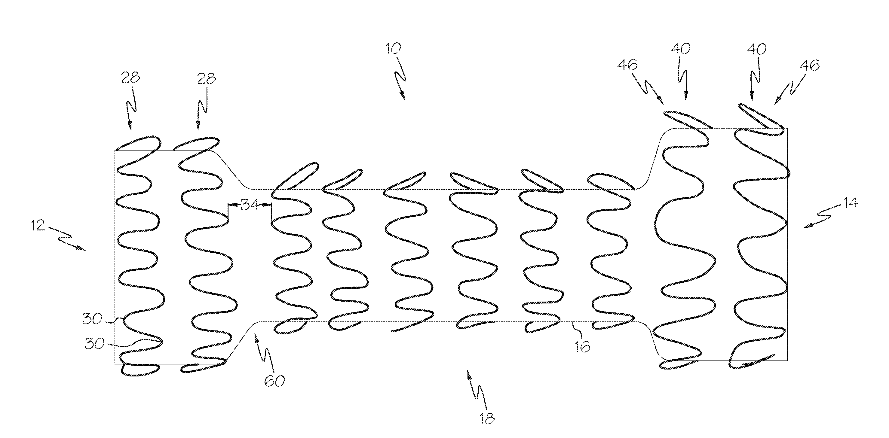 Controlled ingrowth feature for antimigration