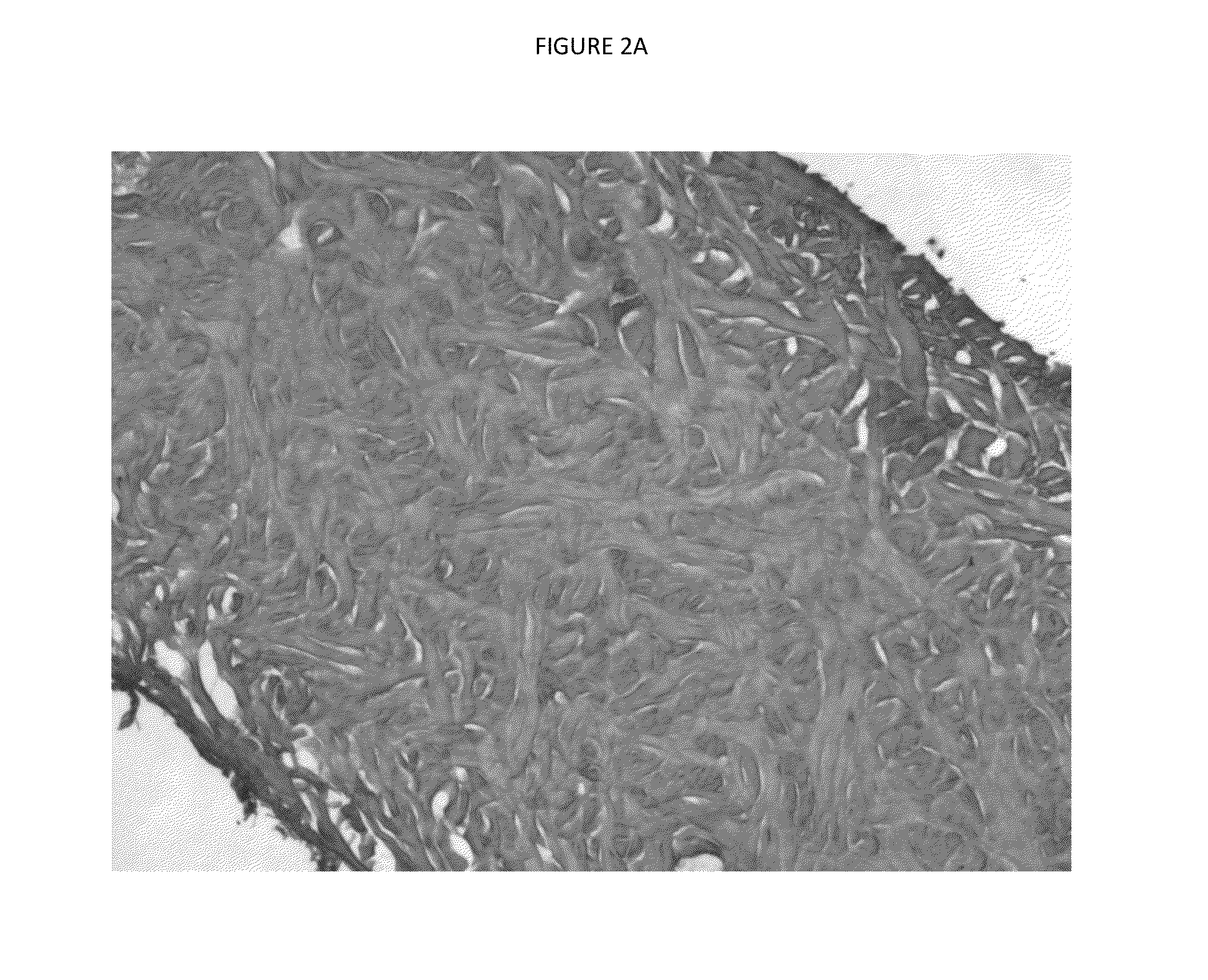 Xenograft soft tissue implants and methods of making