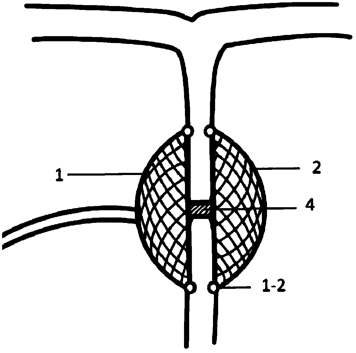 A wireless atrial pacing device implanted through the catheter