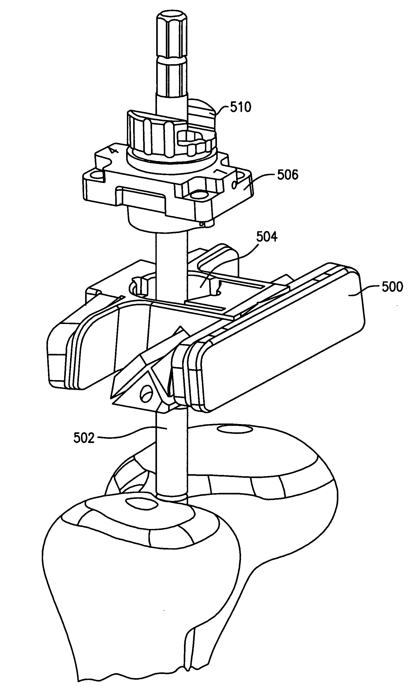 Adjustable offset bushing