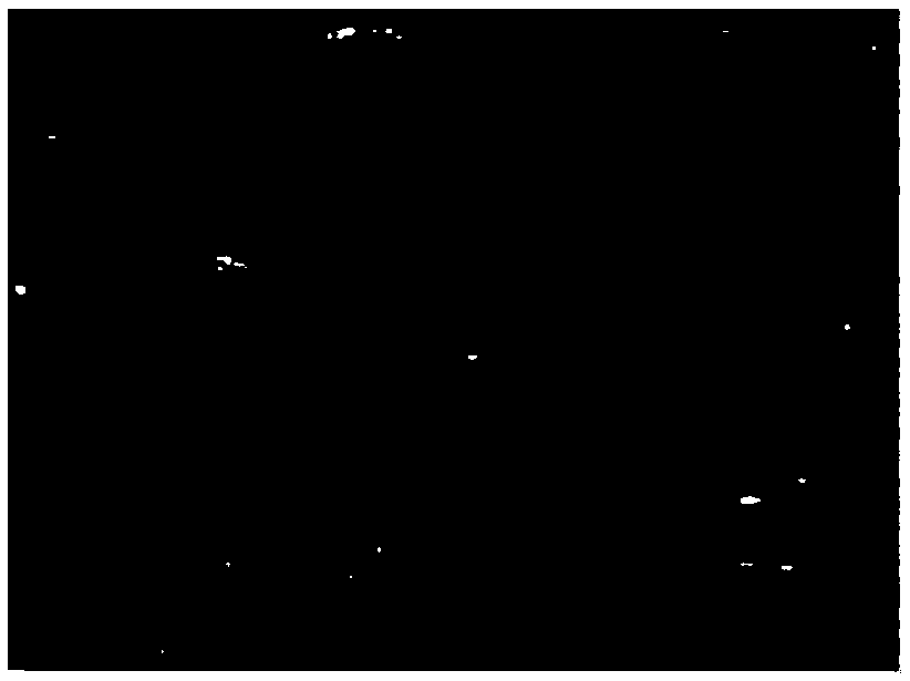 Ultrasonic image segmentation method