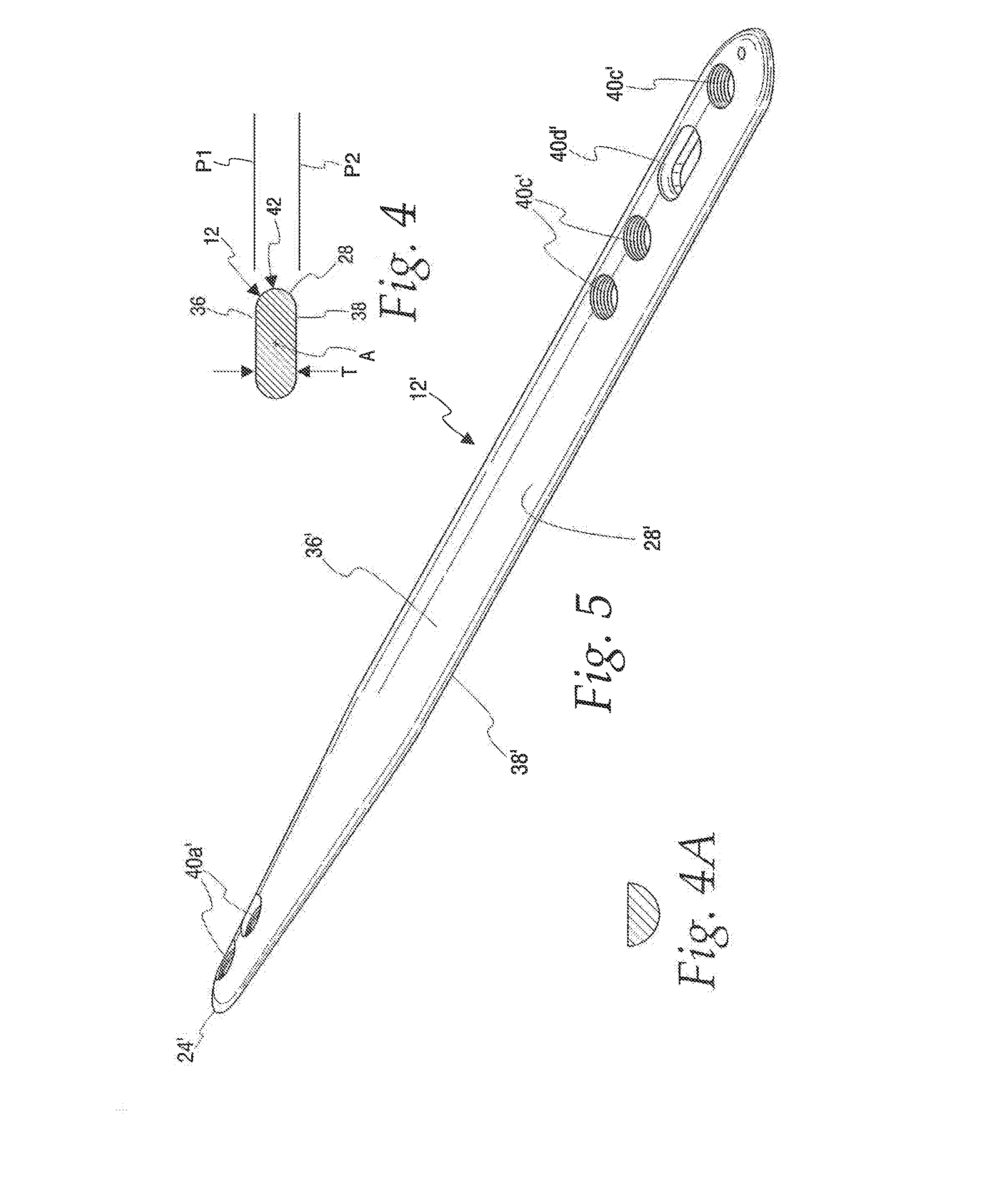 Method of securing a plate to a bone at a fracture site utilizing a detachable inserter