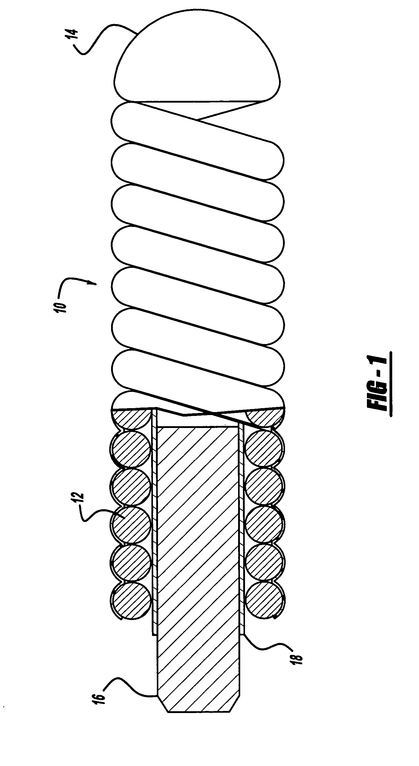 Activatable foam expandable implantable medical device and method of use