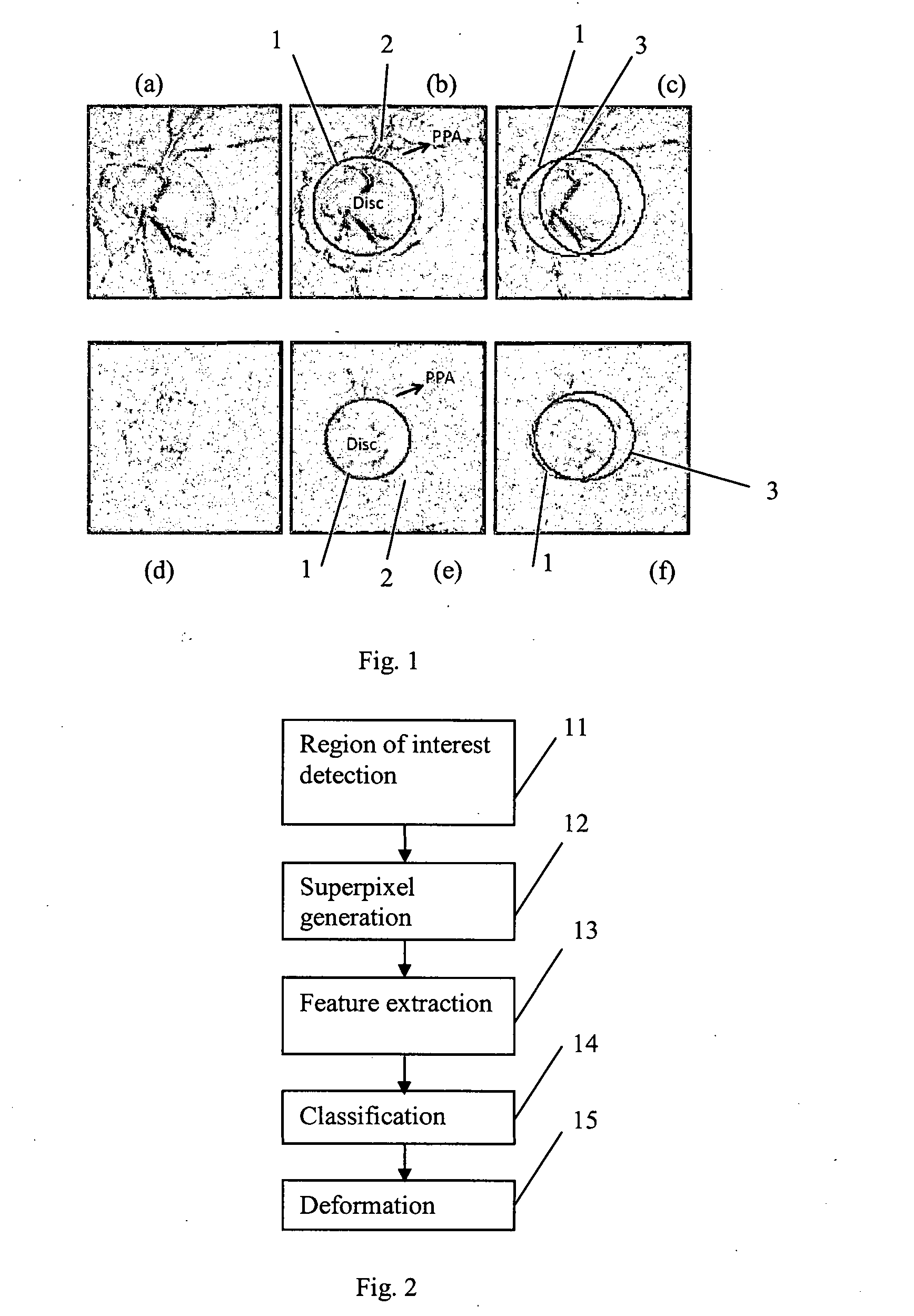 Methods and systems for automatic location of optic structures in an image of an eye, and for automatic retina cup-to-disc ratio computation