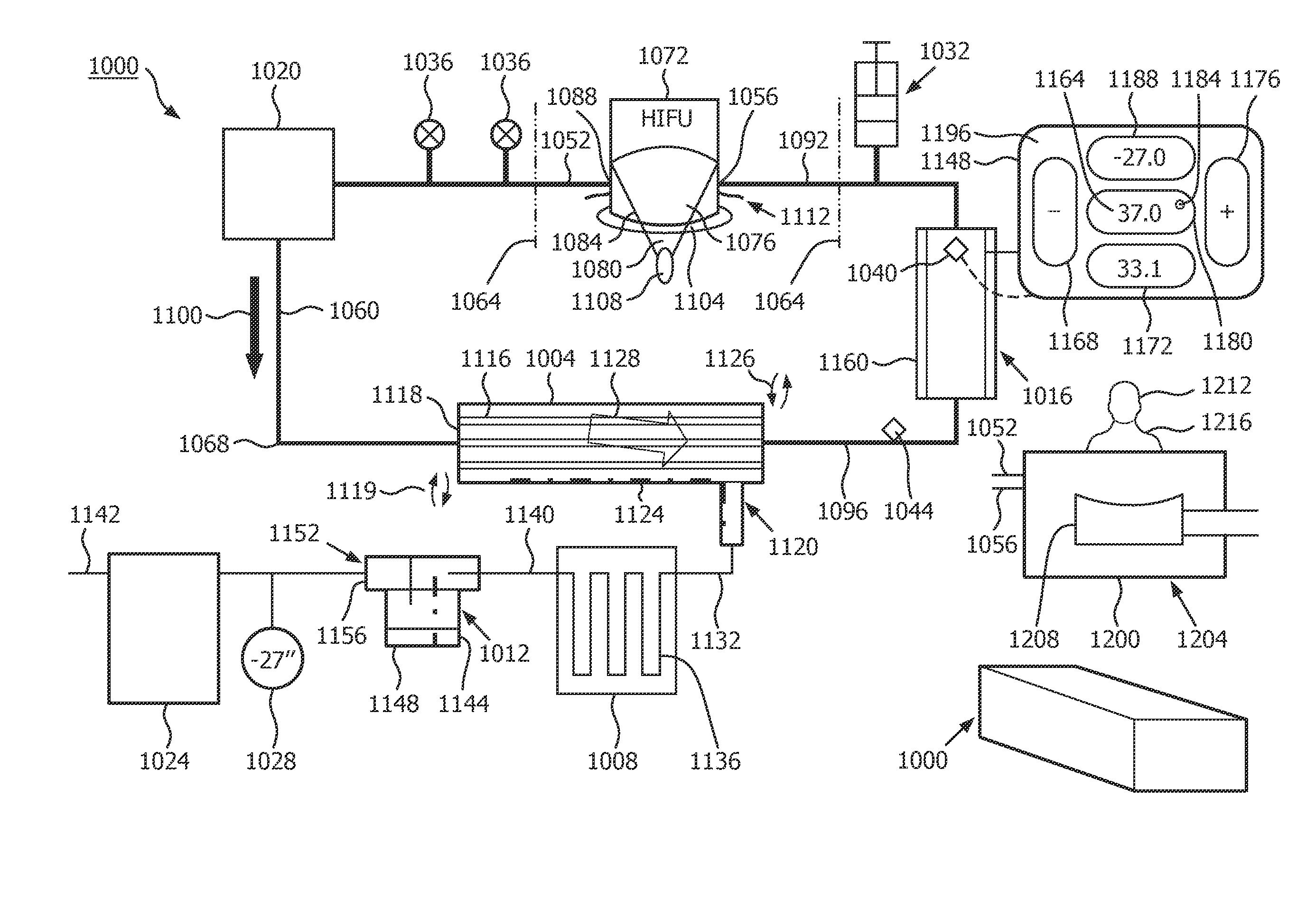 Heat exchange in fluid degassing