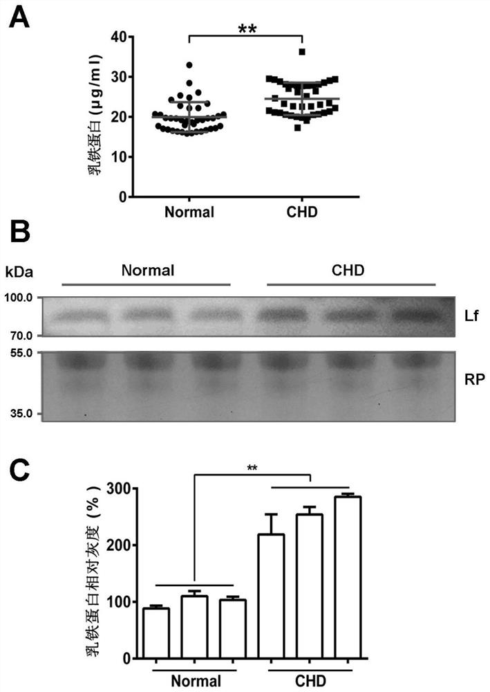 Application of the substance for detecting or regulating the expression level of lactoferrin in the preparation of drugs or kits for preventing and/or treating cardiovascular and cerebrovascular diseases