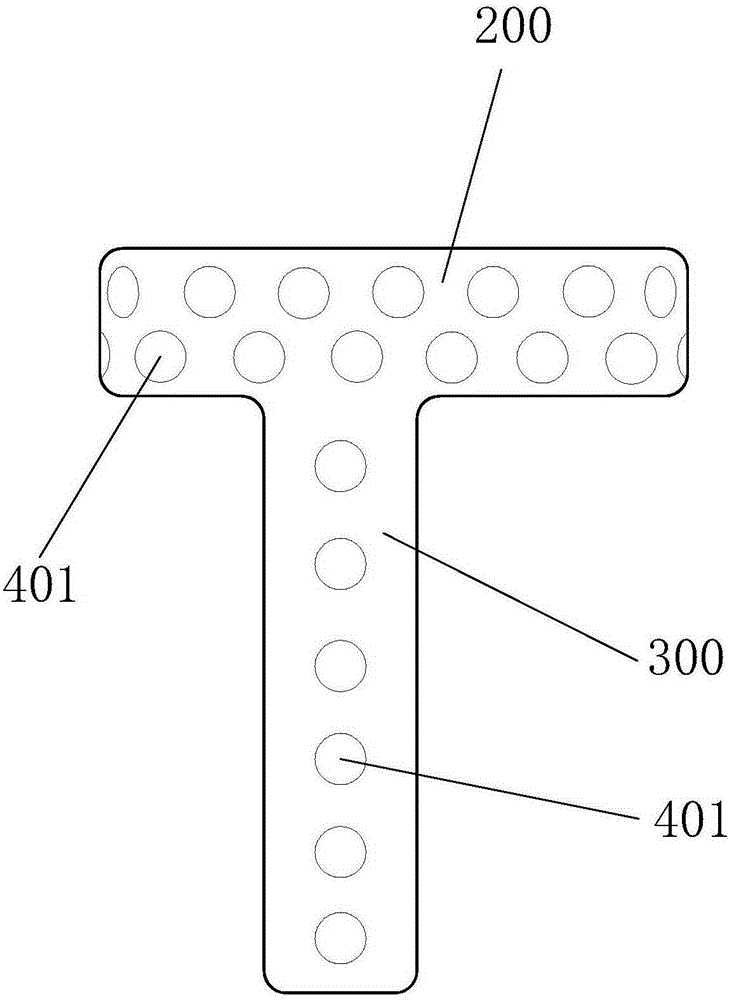 Fixing system for treating fracture of tibial plateau