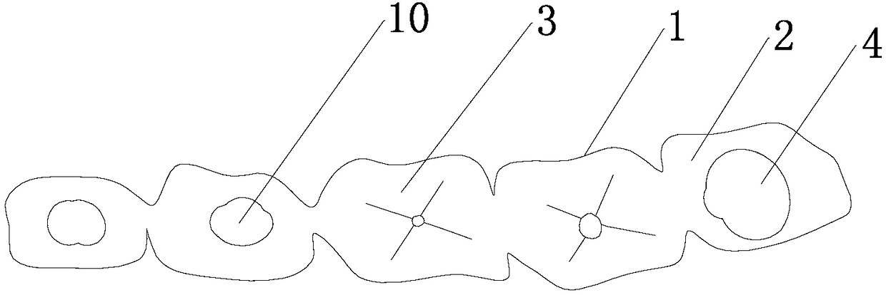 Convenient-to-mount dental prosthesis