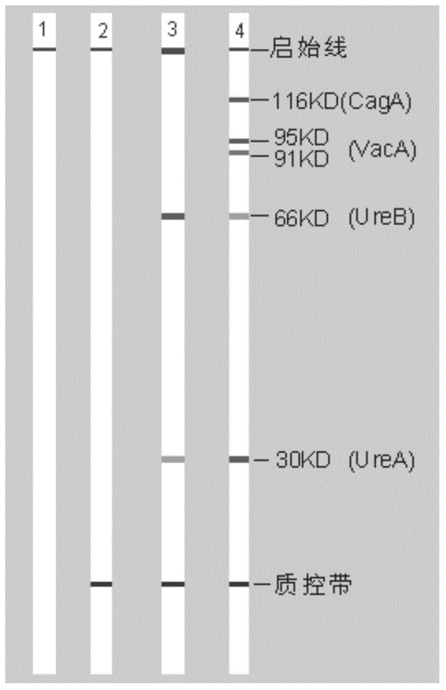 Kit for typing detection of helicobacter pylori