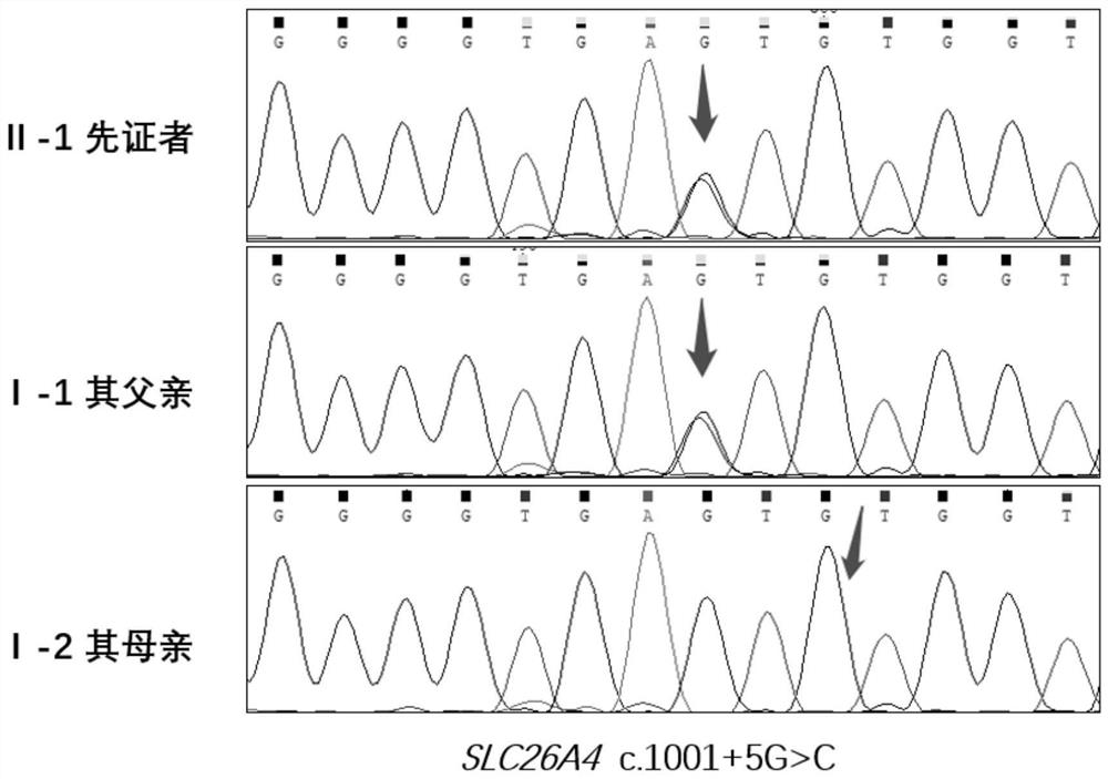 SLC26A4 gene mutant and application thereof