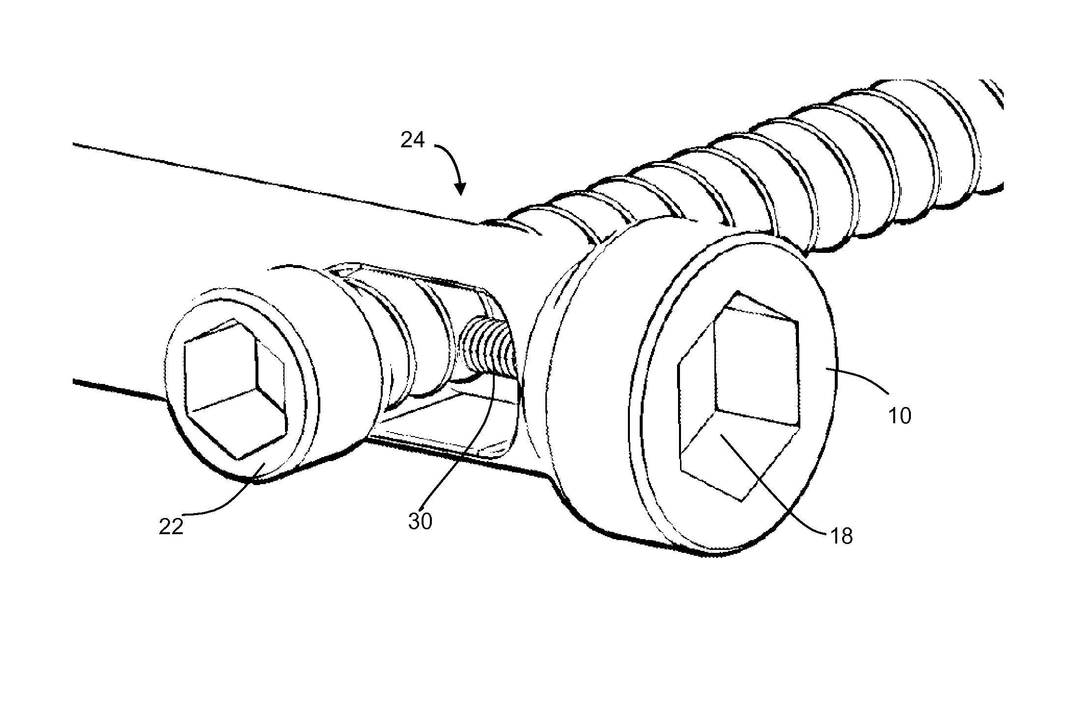 Bone screw fixation system