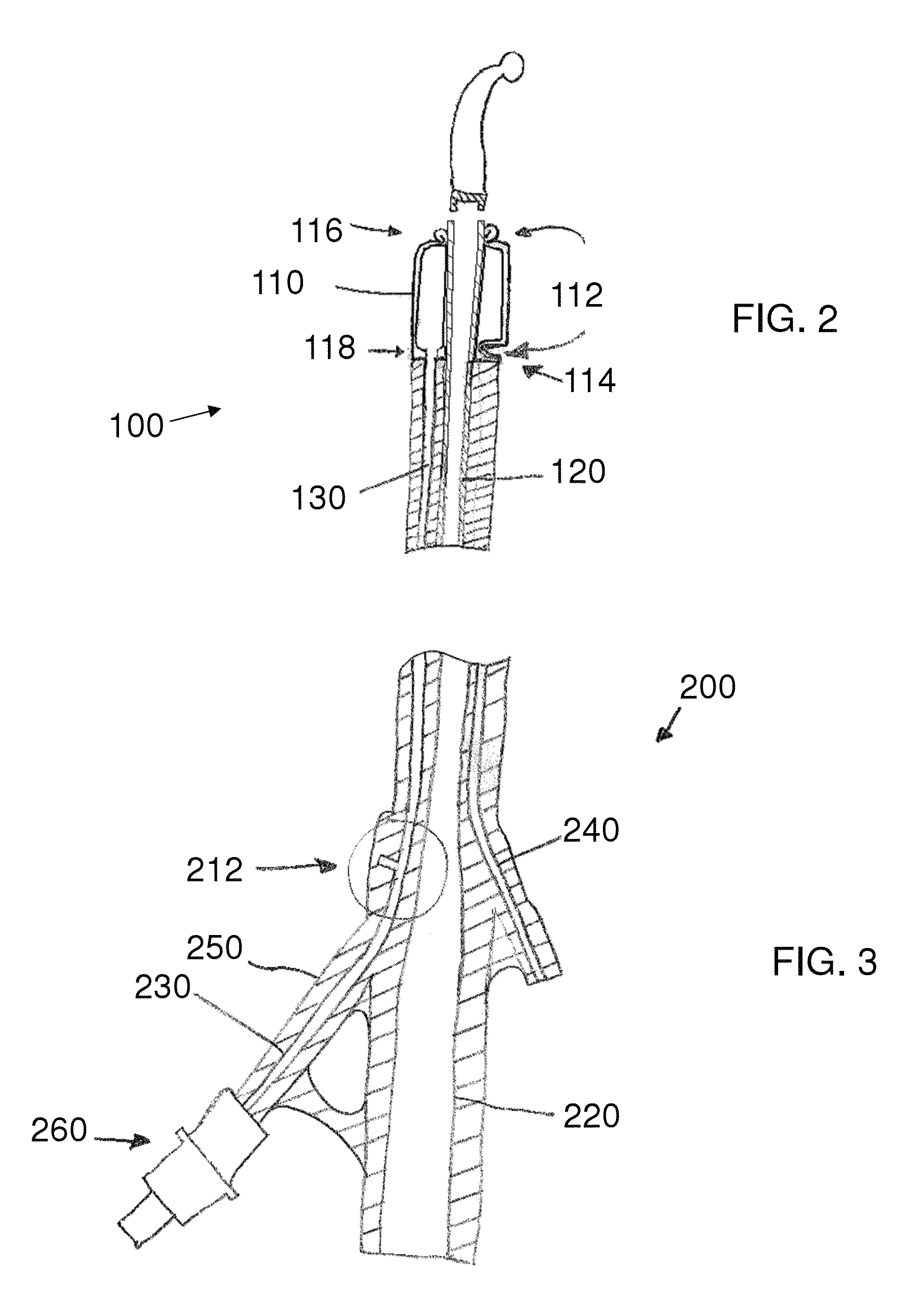 Stretch valve balloon catheter and methods for producing and using same