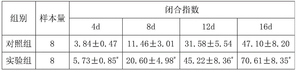 Traditional Chinese medicine composition capable of promoting wound healing and preparation method of composition