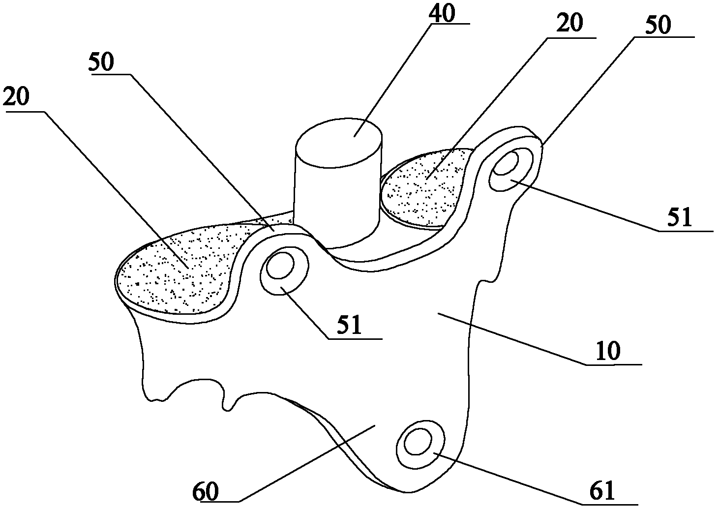 Fusion prosthesis