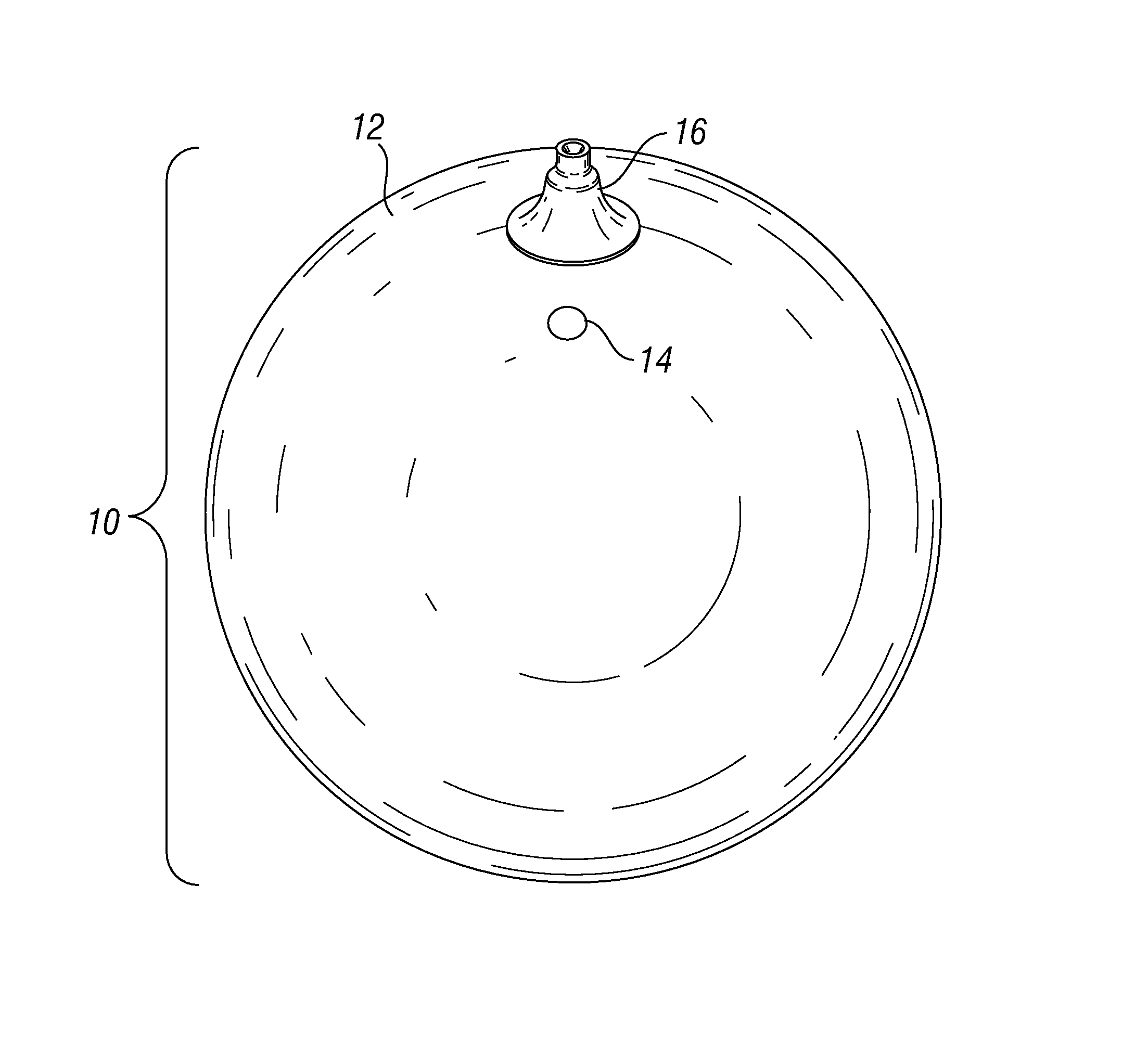 Pressure sensing intragastric balloon