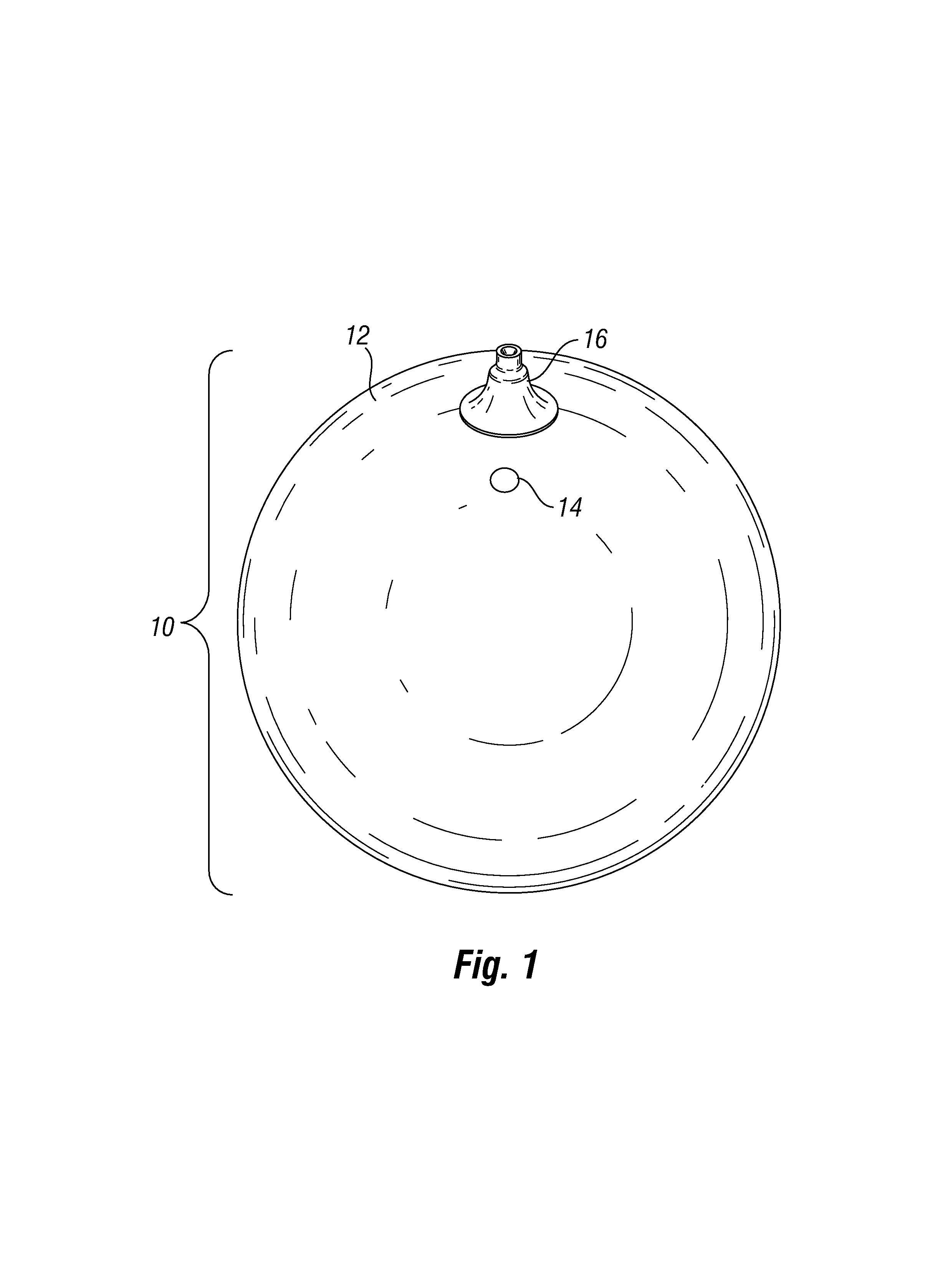 Pressure sensing intragastric balloon