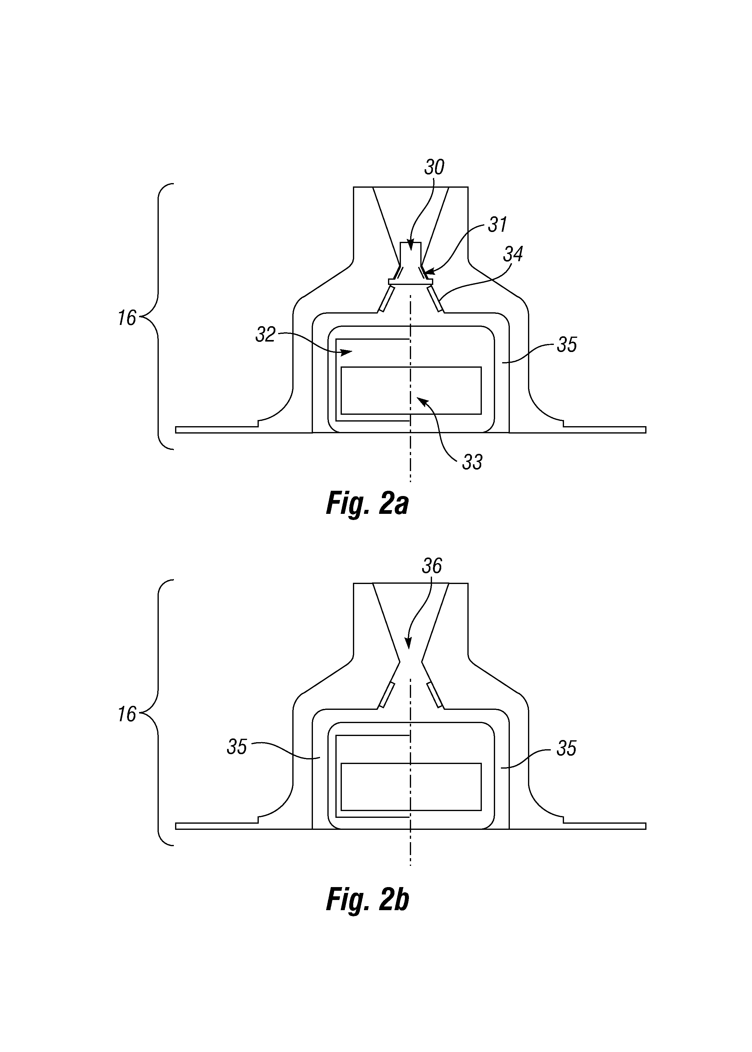 Pressure sensing intragastric balloon