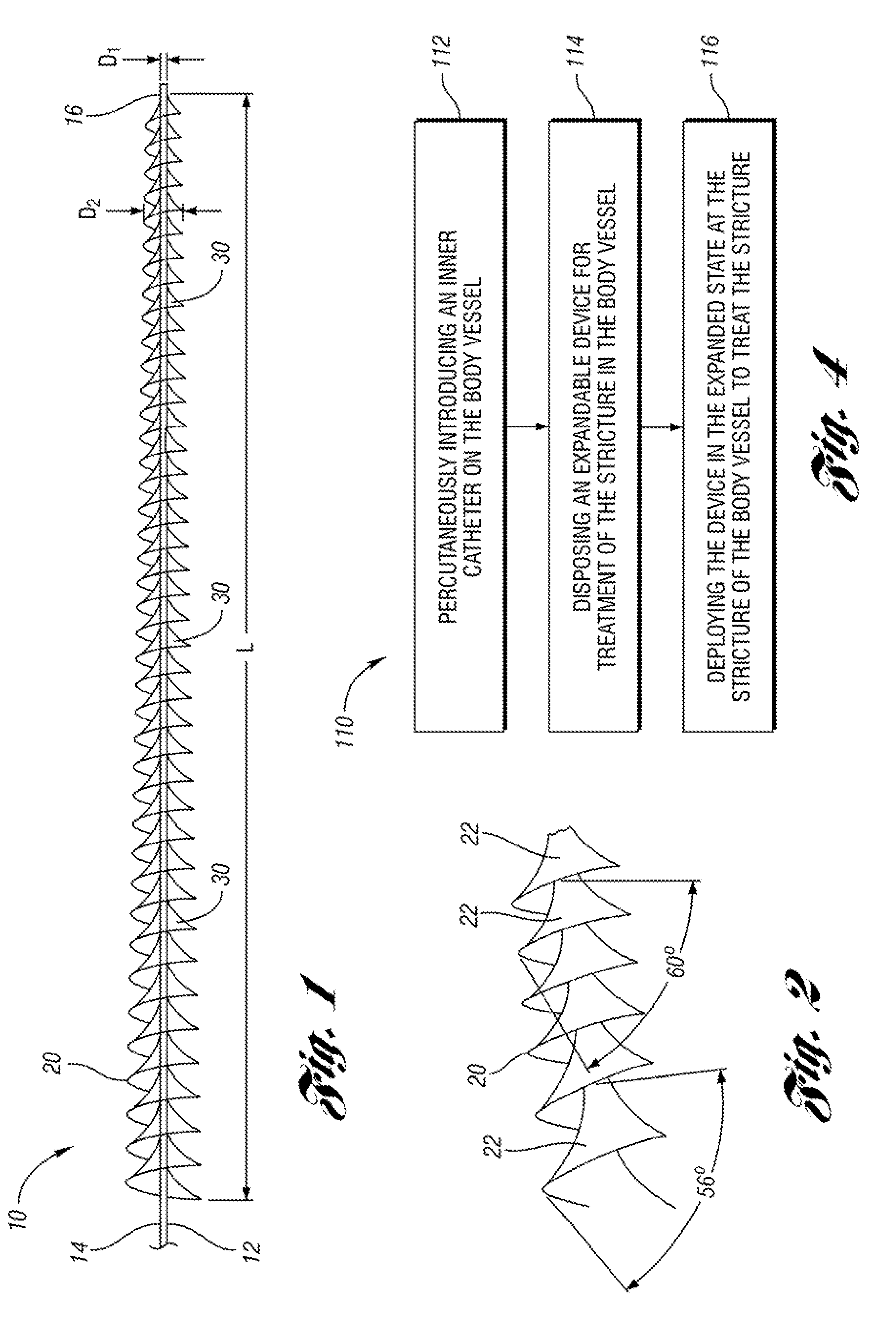 Expandable device for treatment of a stricture in a body vessel