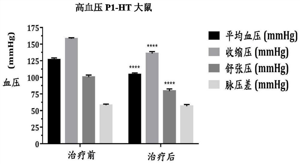 Application of ophioglossum and rhizoma curcumae longae composition to preparation of pharmaceutical composition for lowering blood sugar and blood pressure