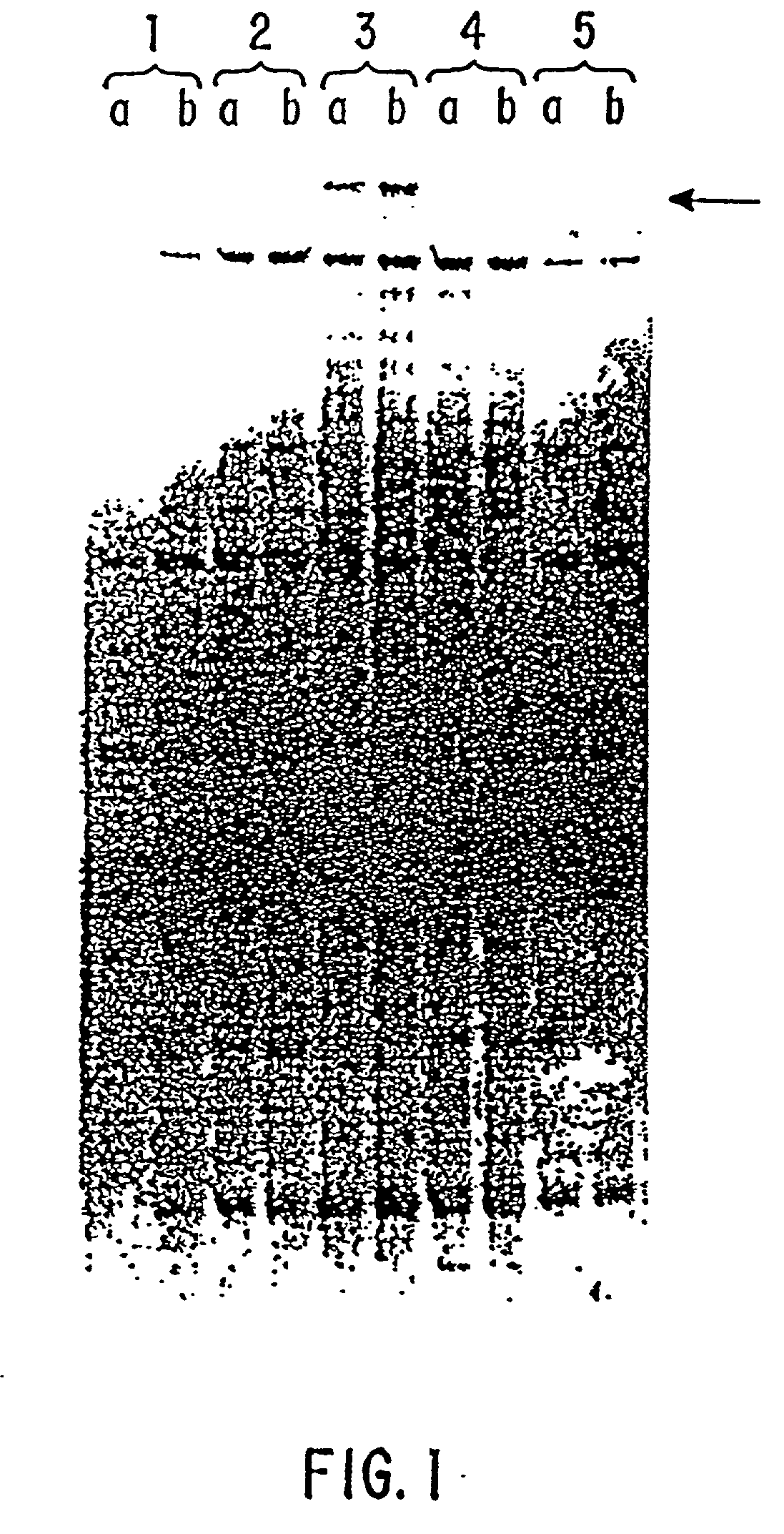 Compositions and methods for the treatment and diagnosis of immune disorders