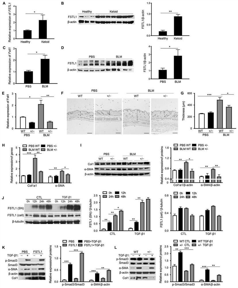 Neutralizing antibody of follistatin-like 1 and application thereof