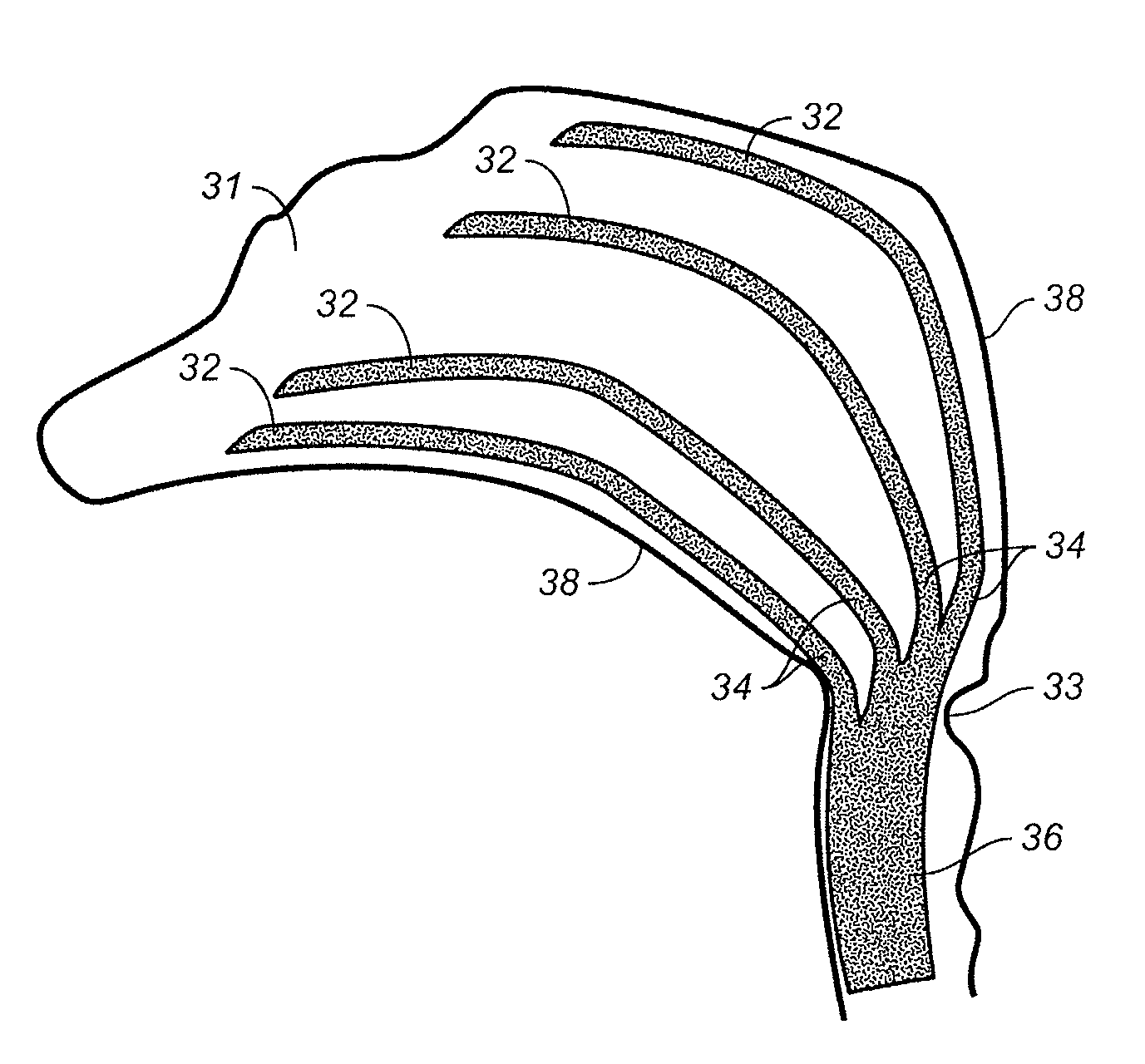 Device and methods for treating paranasal sinus conditions