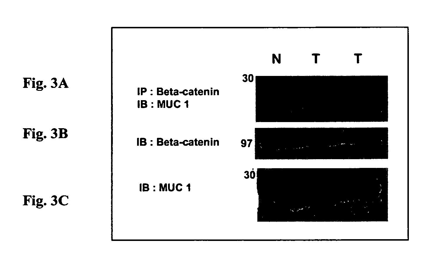 Therapeutic peptides for the treatment of metastatic cancer