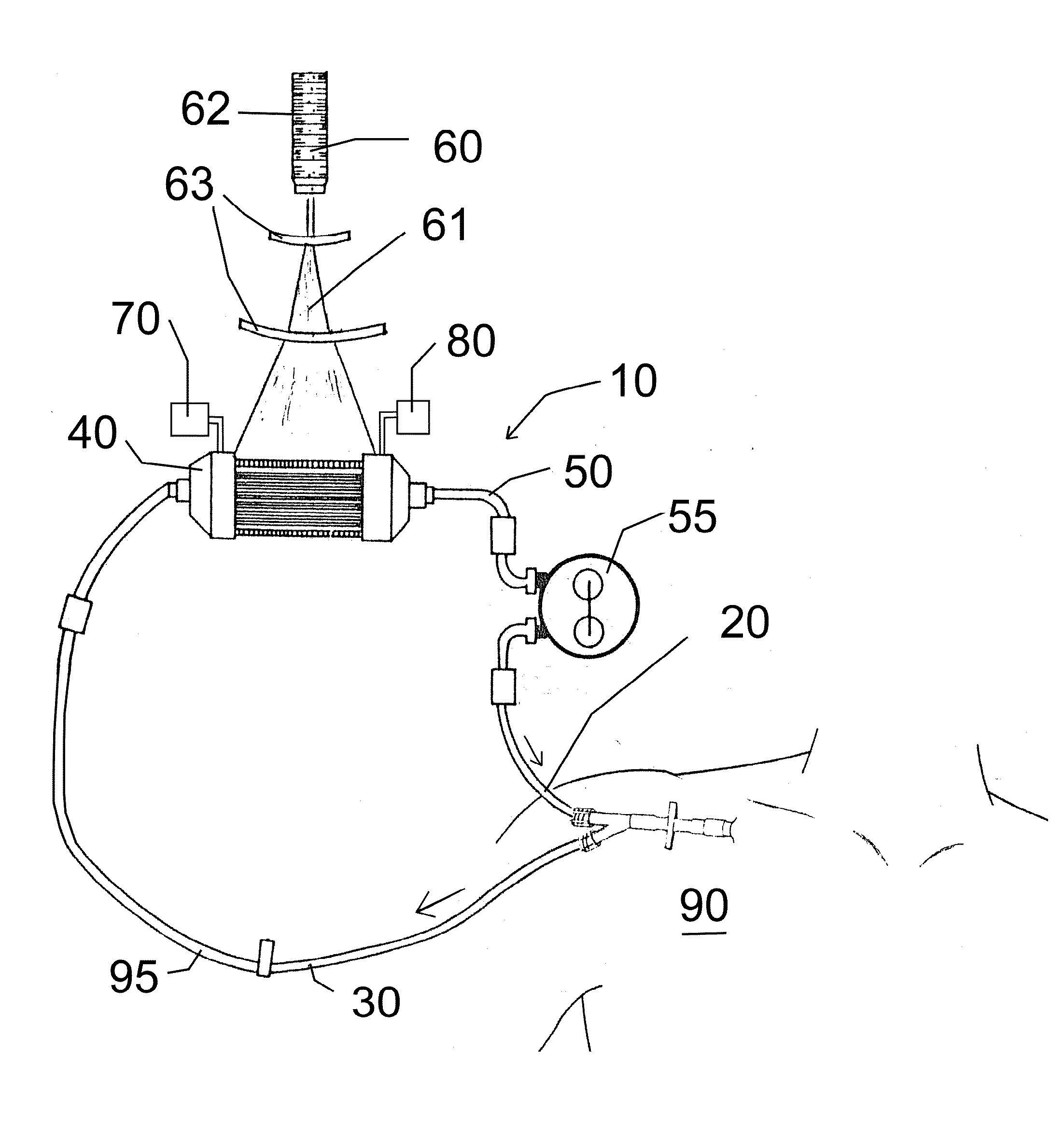 Extracorporeal photodynamic blood illumination (irradiation) for the treatment of carbon monoxide poisoning