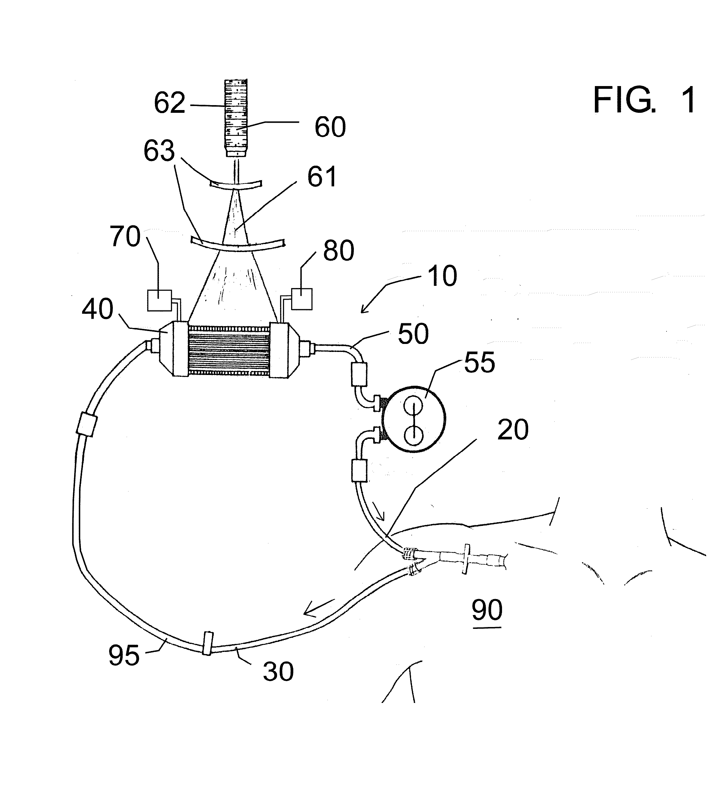 Extracorporeal photodynamic blood illumination (irradiation) for the treatment of carbon monoxide poisoning