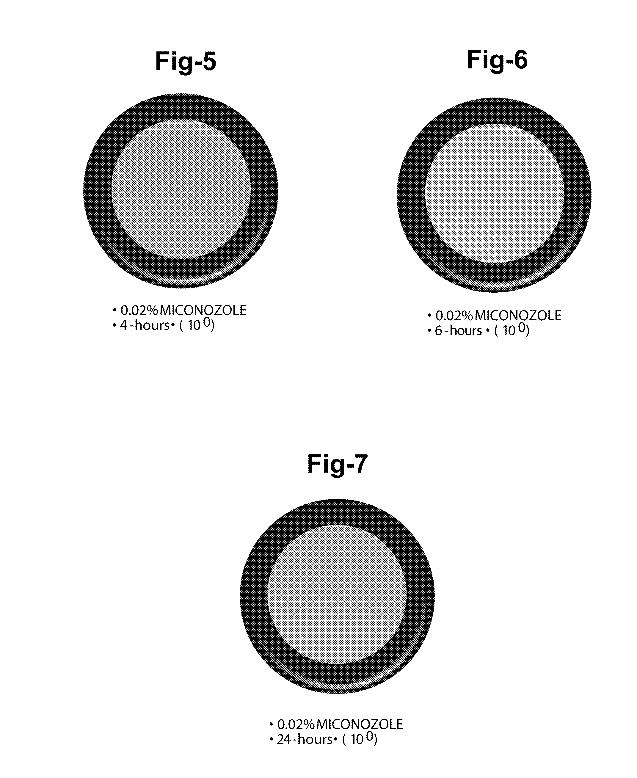 Ophthalmic and related aqueous solutions containing antifungal agents, uses therefor and methods for preparing them