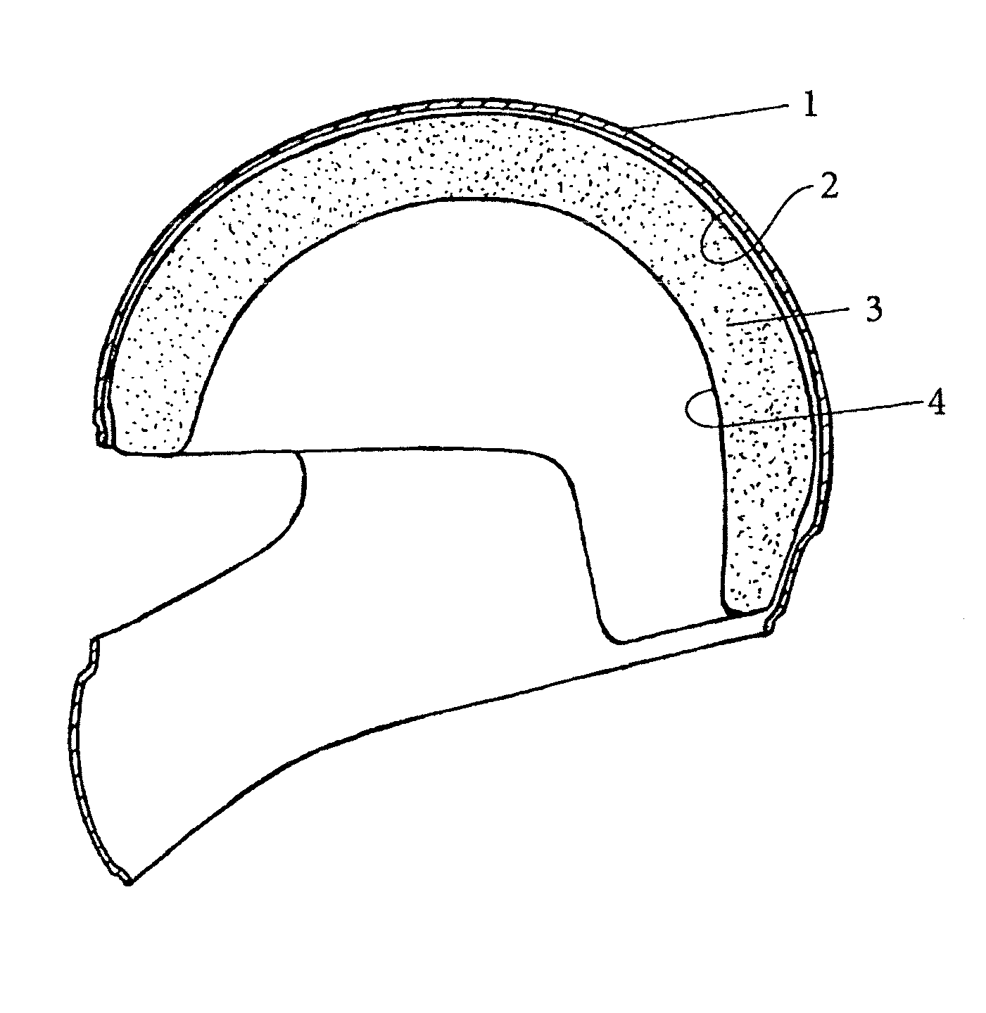 Protective helmet; method for reducing or preventing a head injury