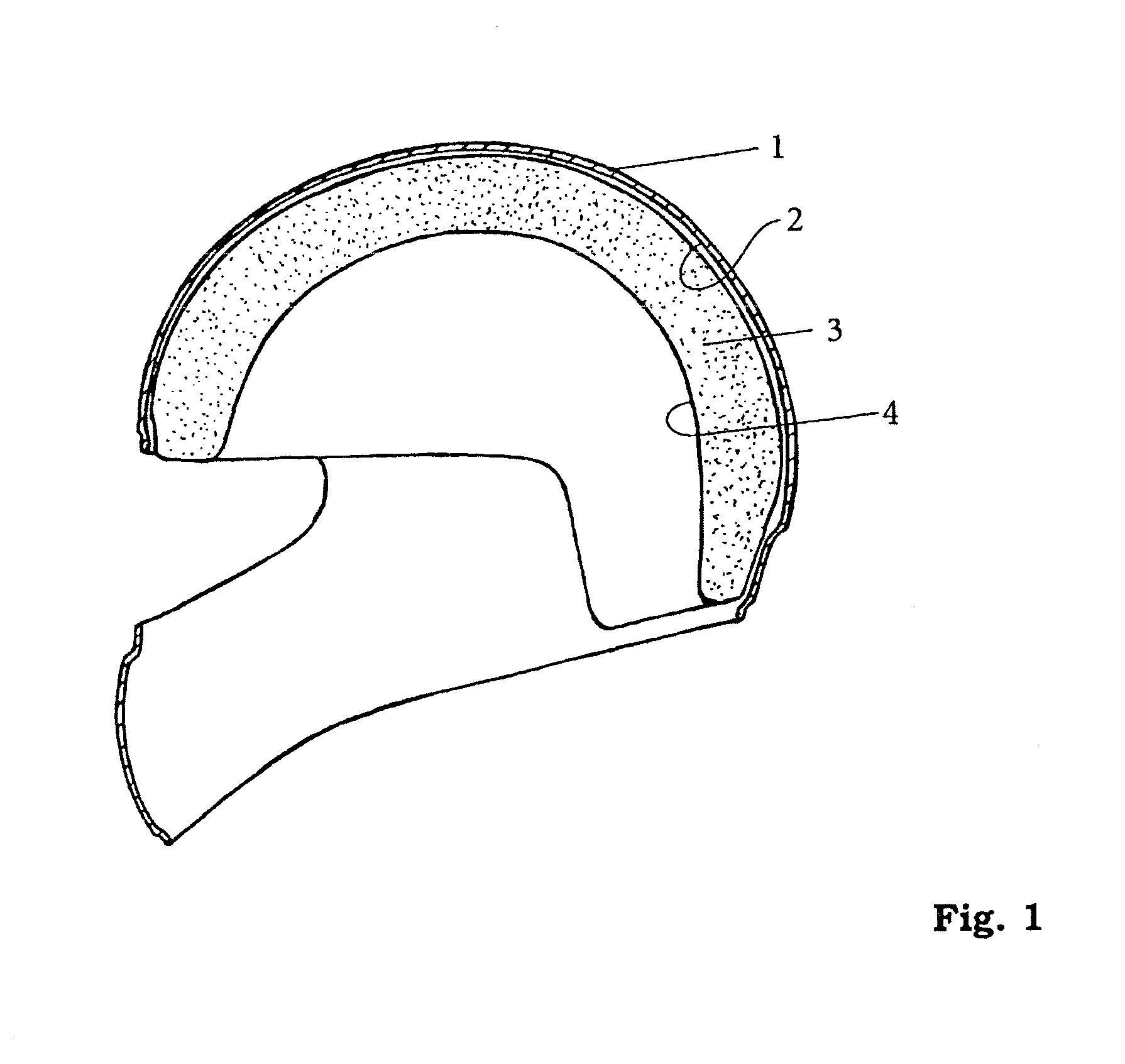 Protective helmet; method for reducing or preventing a head injury