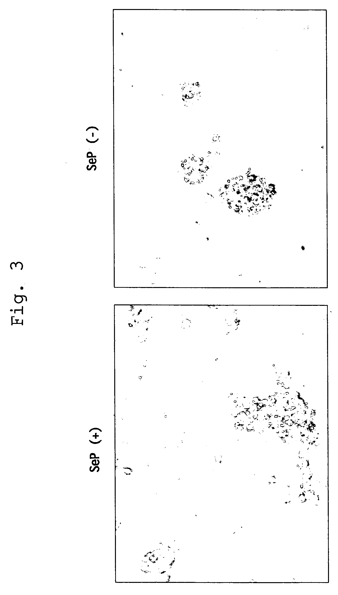 Novel medicament for ameliorating dyskinesia