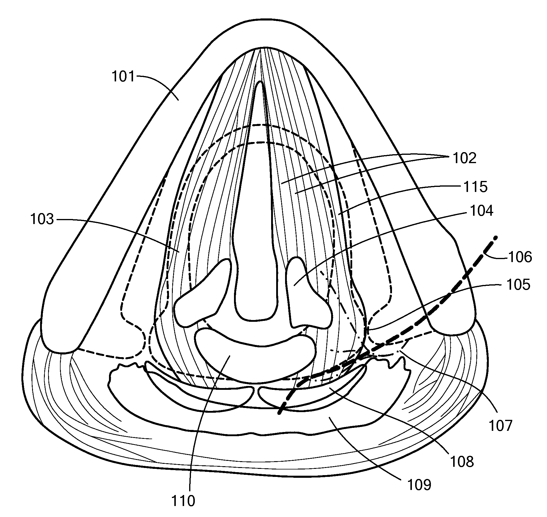 System, Apparatus, and Method for Facilitating Interface with Laryngeal Structures