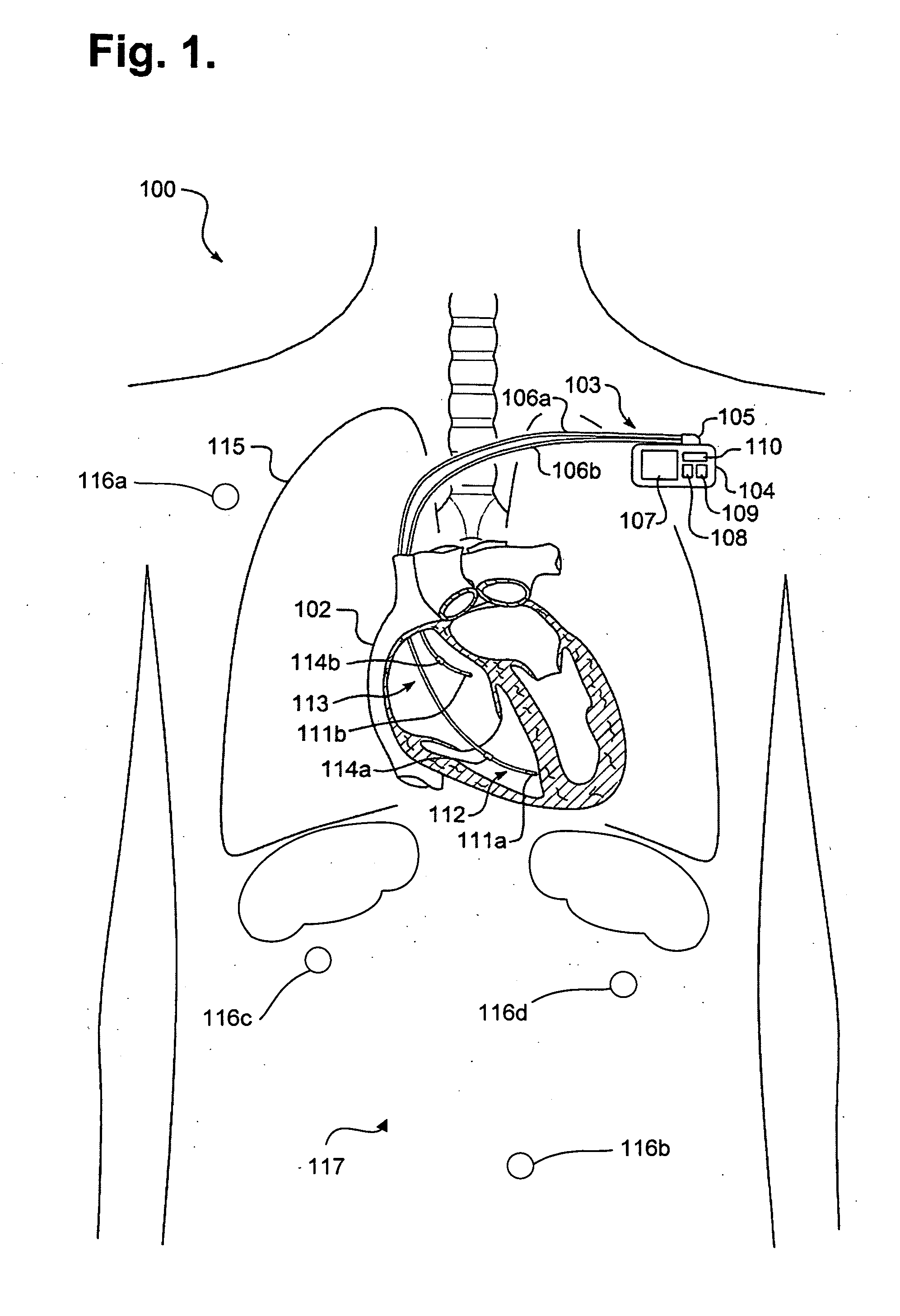 System and method for providing digital data communications over a wireless intra-body network