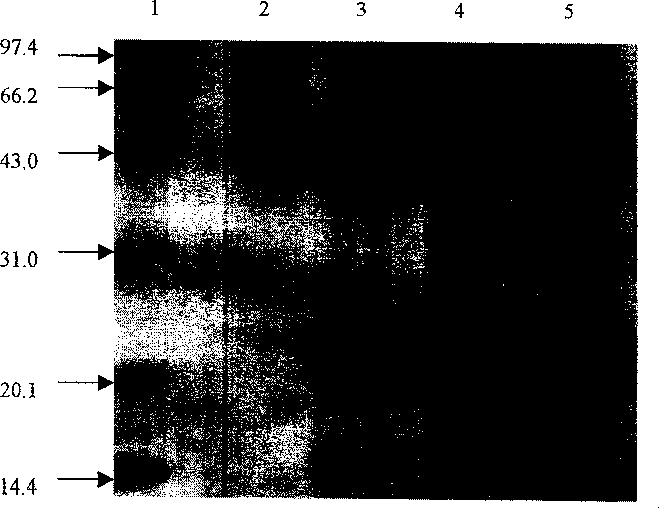 Recombinant malignant malarial parasite hypoxanthine-guanine-xanthine phosphoribosyl transferase and its preparing method and use