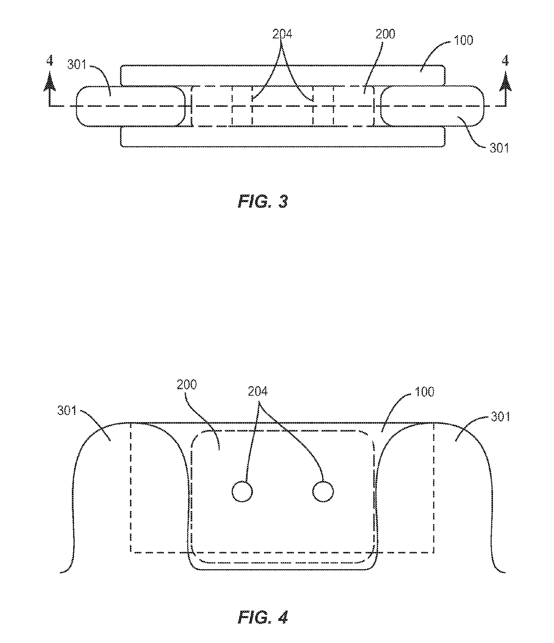 Interspinous bone implant device