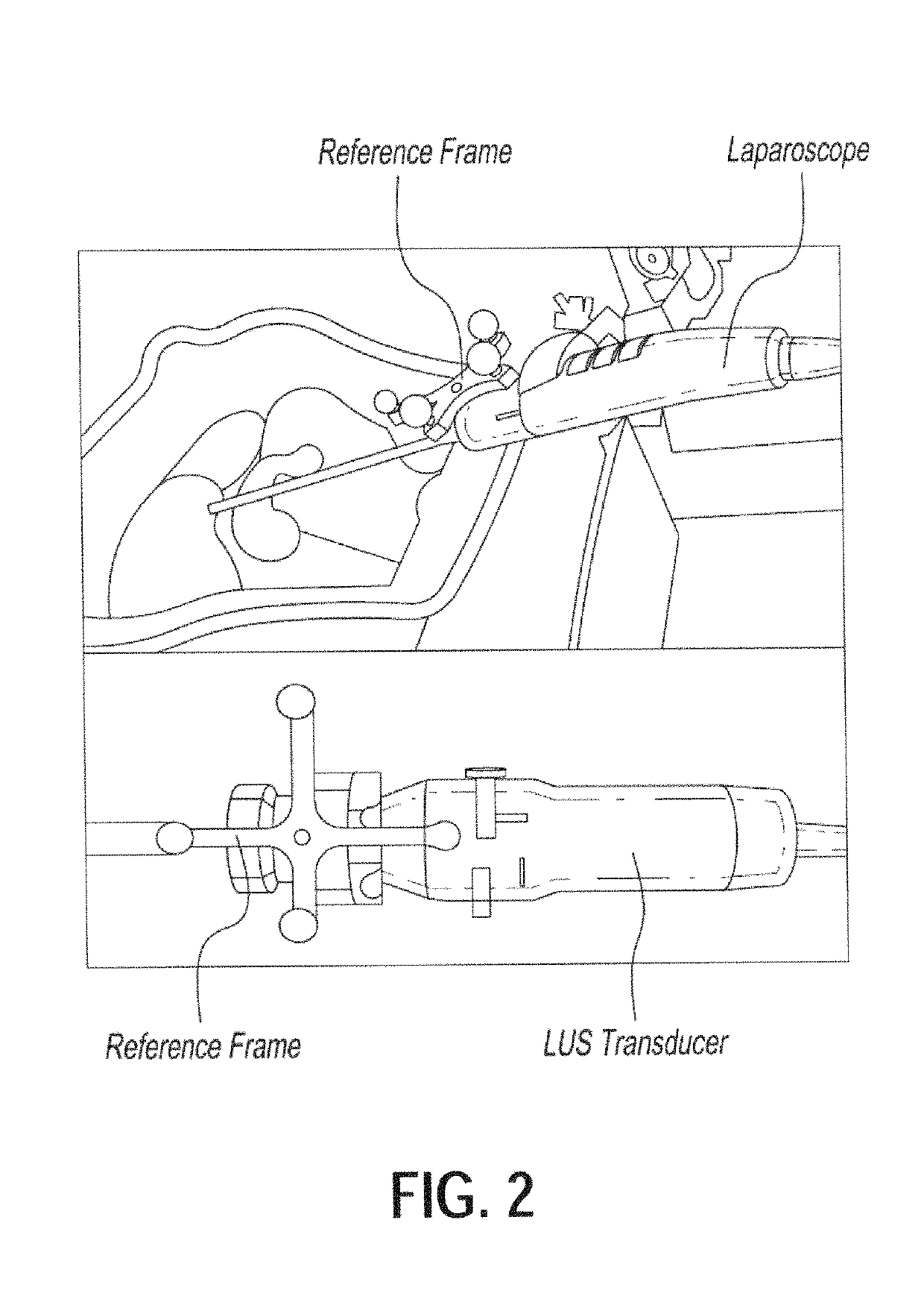 System for generating composite images for endoscopic surgery of moving and deformable anatomy