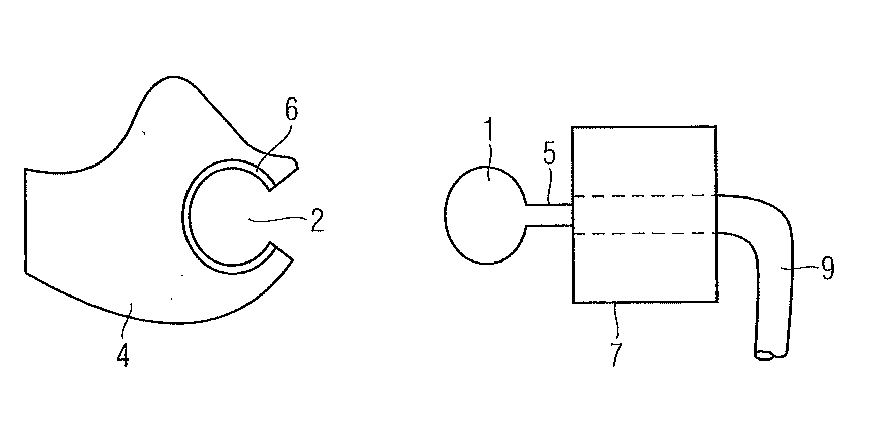 Ear mold for a hearing device